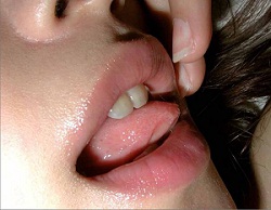 �ꌂ�ŃL�X��������@